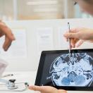 Doctors looking at a brain scan
